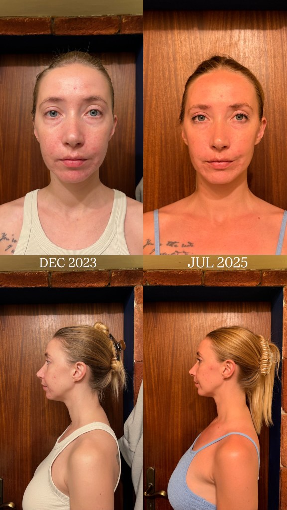 Glow by Anastasia results